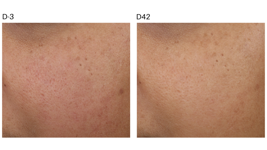 Before After Pictures